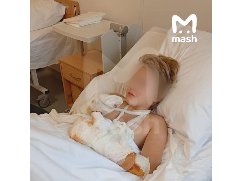 Мальчика, потерявшего пальцы при взрыве мины, спасают от нестерпимой боли